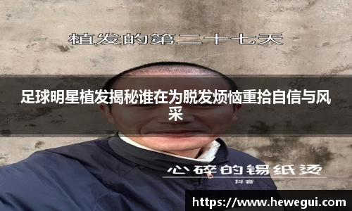 足球明星植发揭秘谁在为脱发烦恼重拾自信与风采